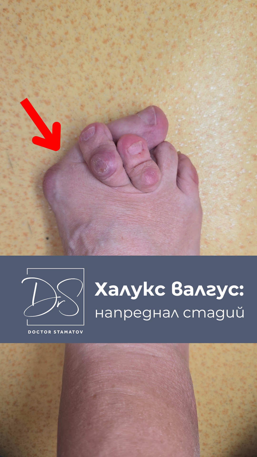 @Д-р Димитър Стаматов
