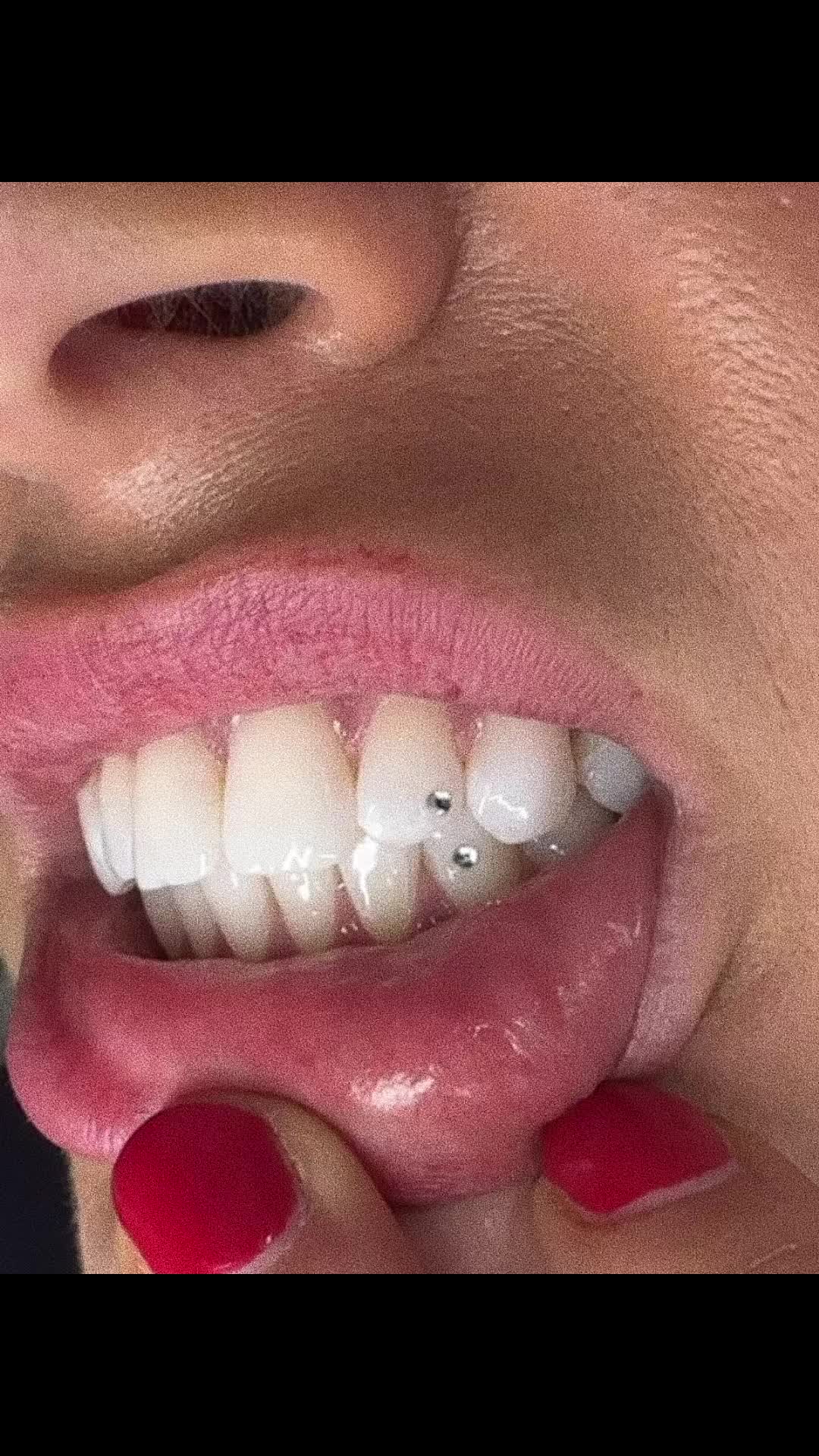 @Zahnschmuck_