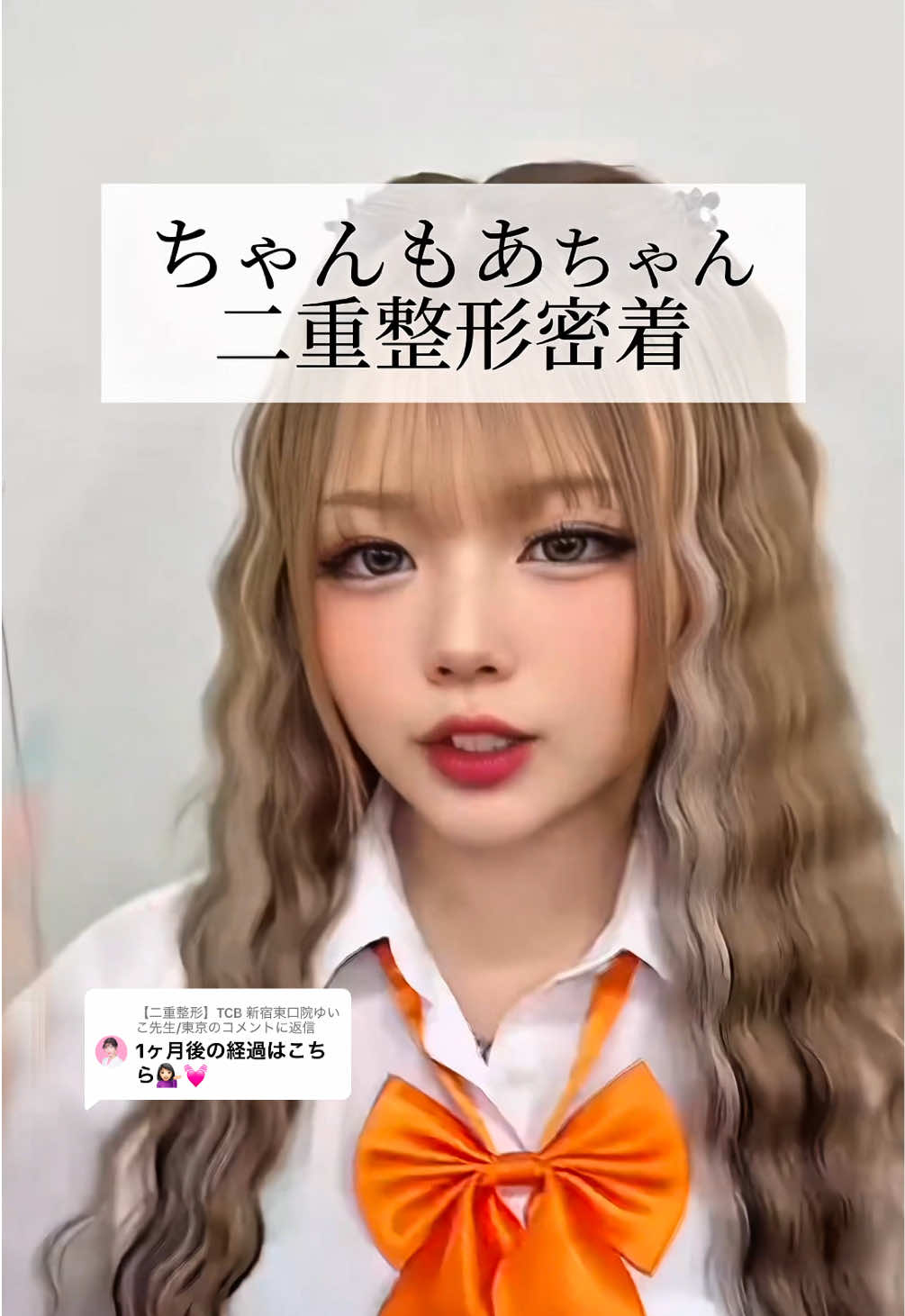 @【二重整形】TCB 新宿東口院ゆいこ先生/東京