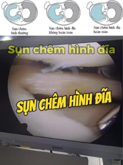 @Chuyên gia xương khớp