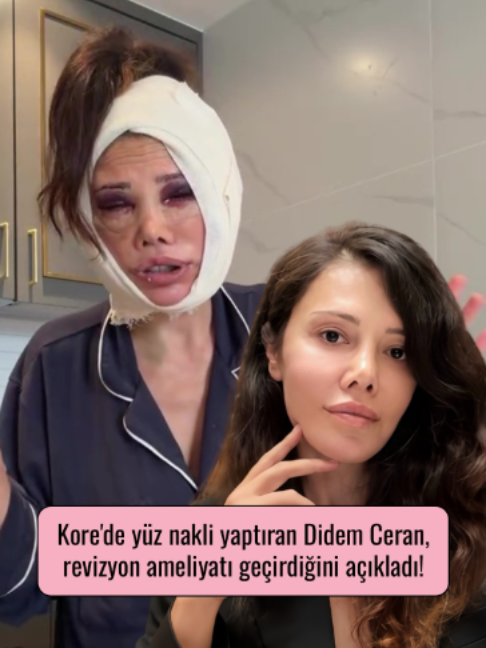 @Mynet Kadin