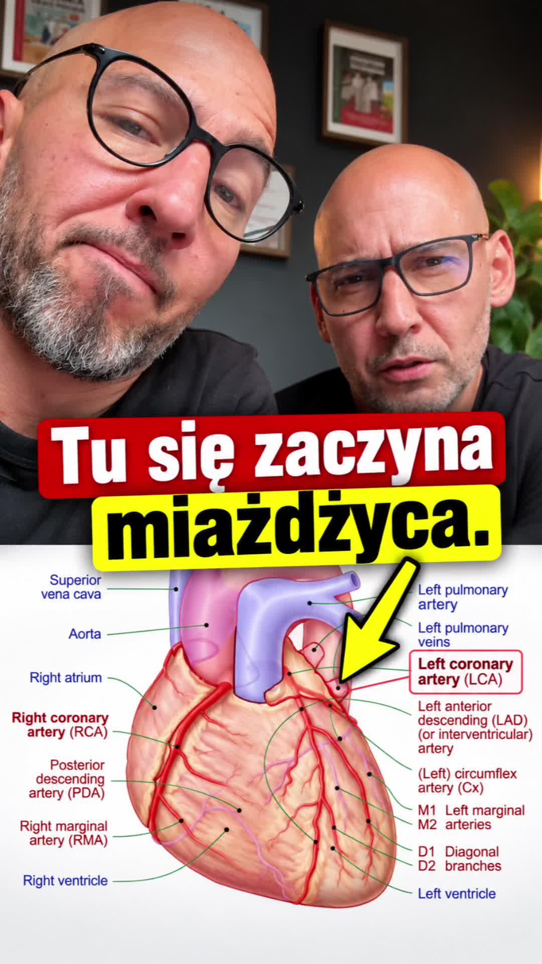 @Bracia Rodzeń