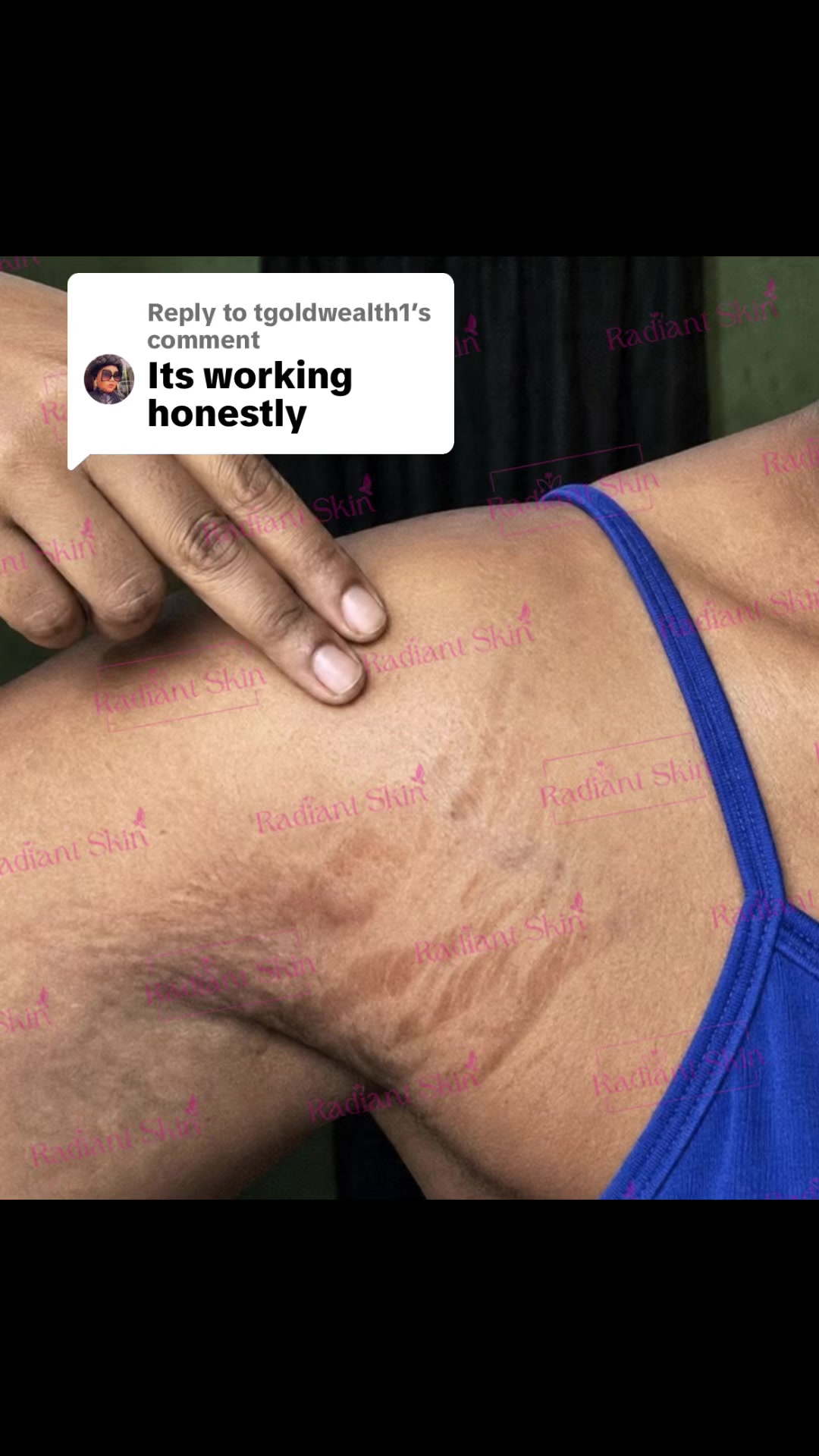 @Radiant skin