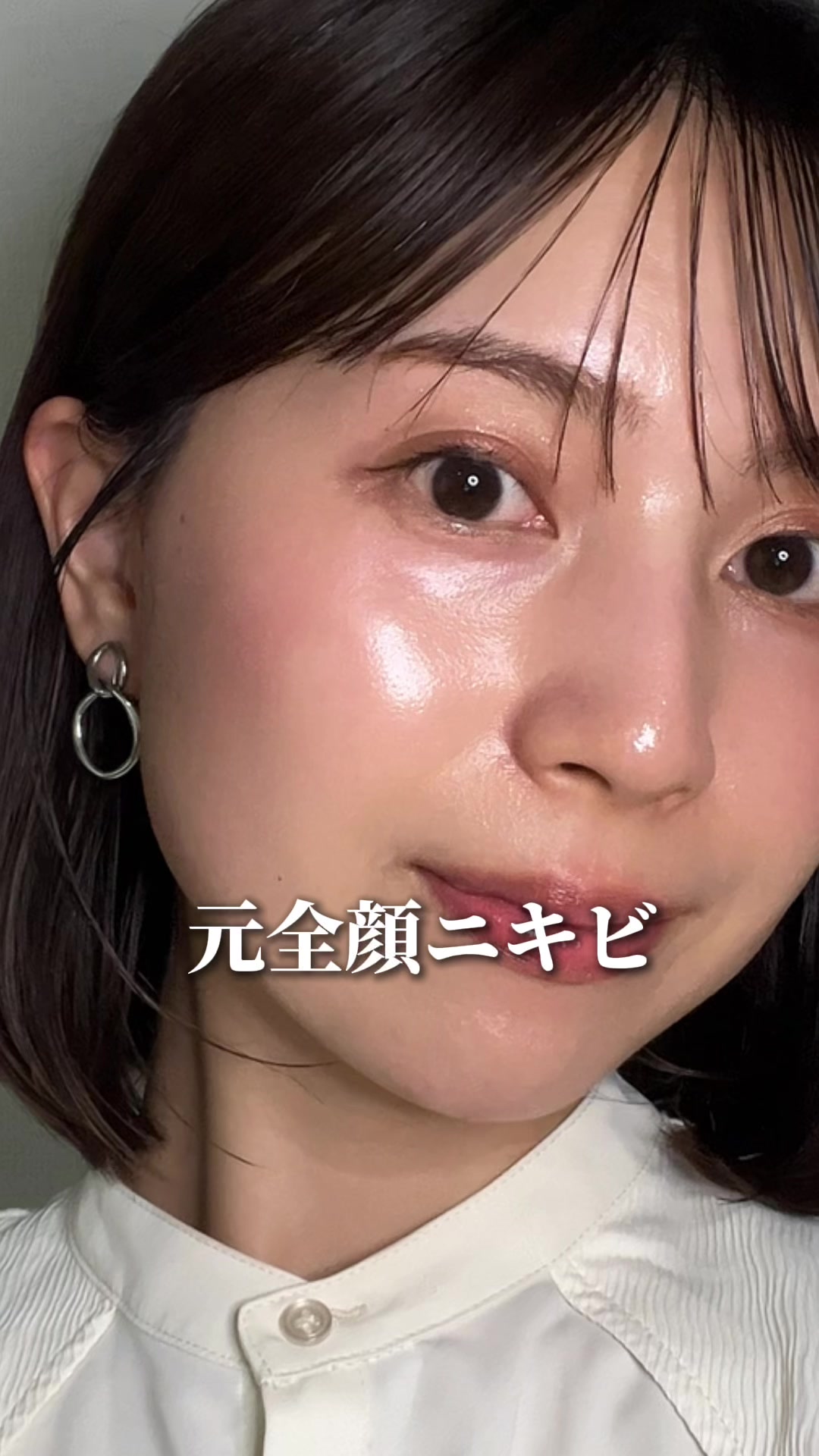 @ニキビ肌から艶肌へ🤍 ari sa