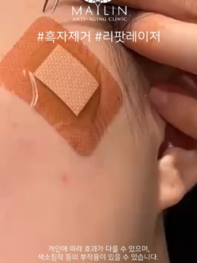 @메이린의원대구점