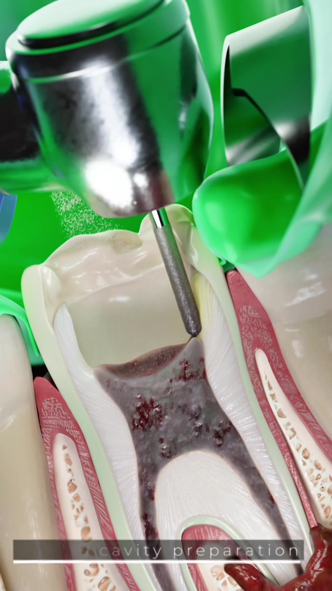 @VOKA 3D Anatomy & Pathology