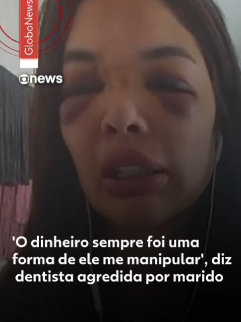 @g1