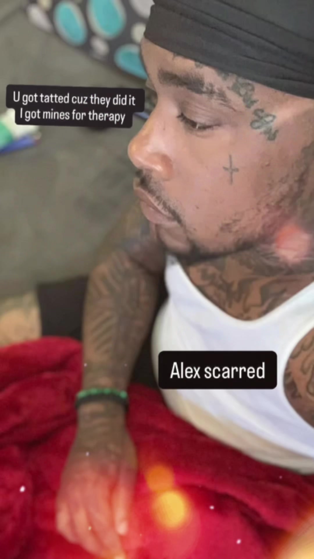 @Alex scarred