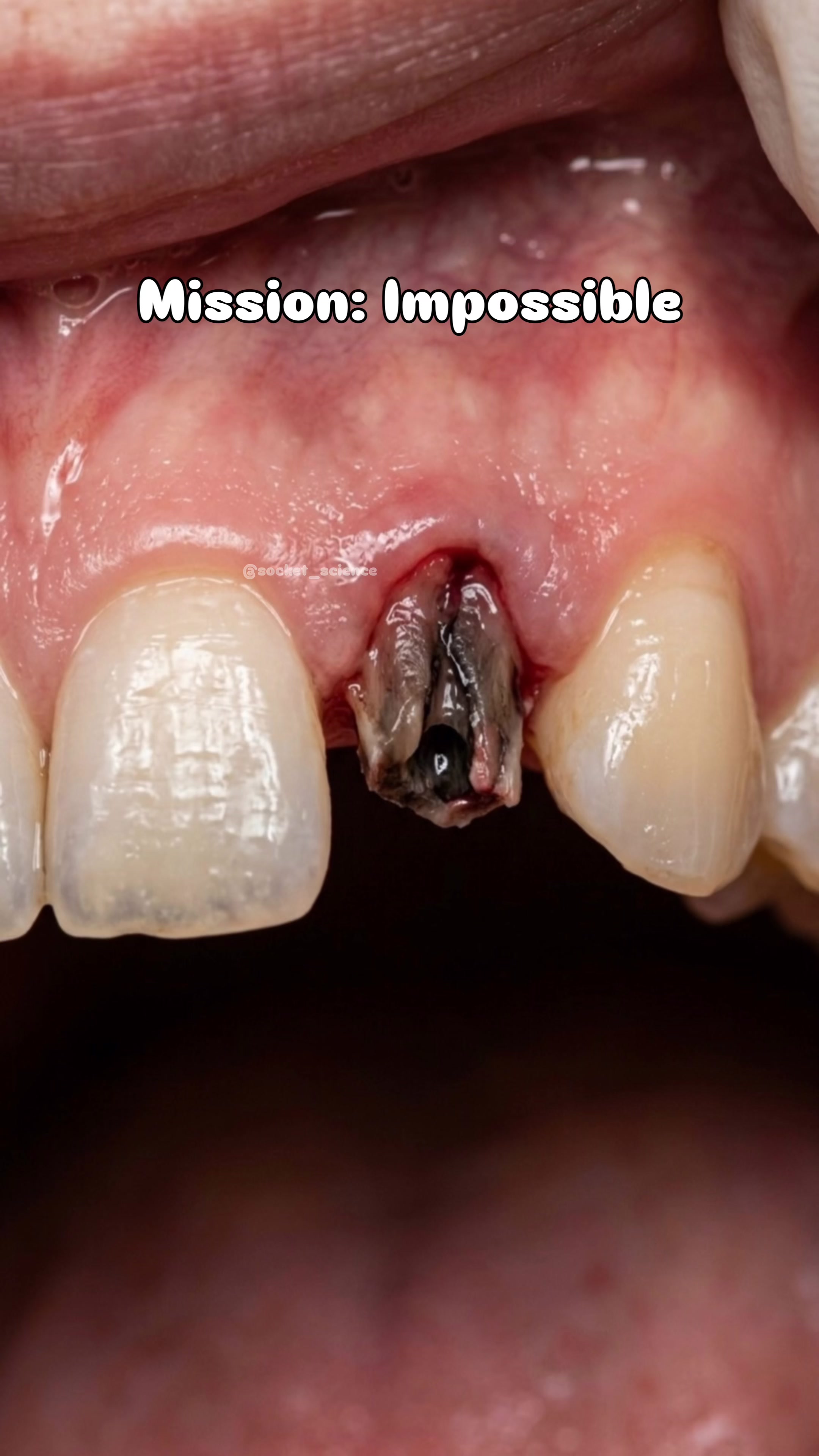 @Socket Science | Dental Visual