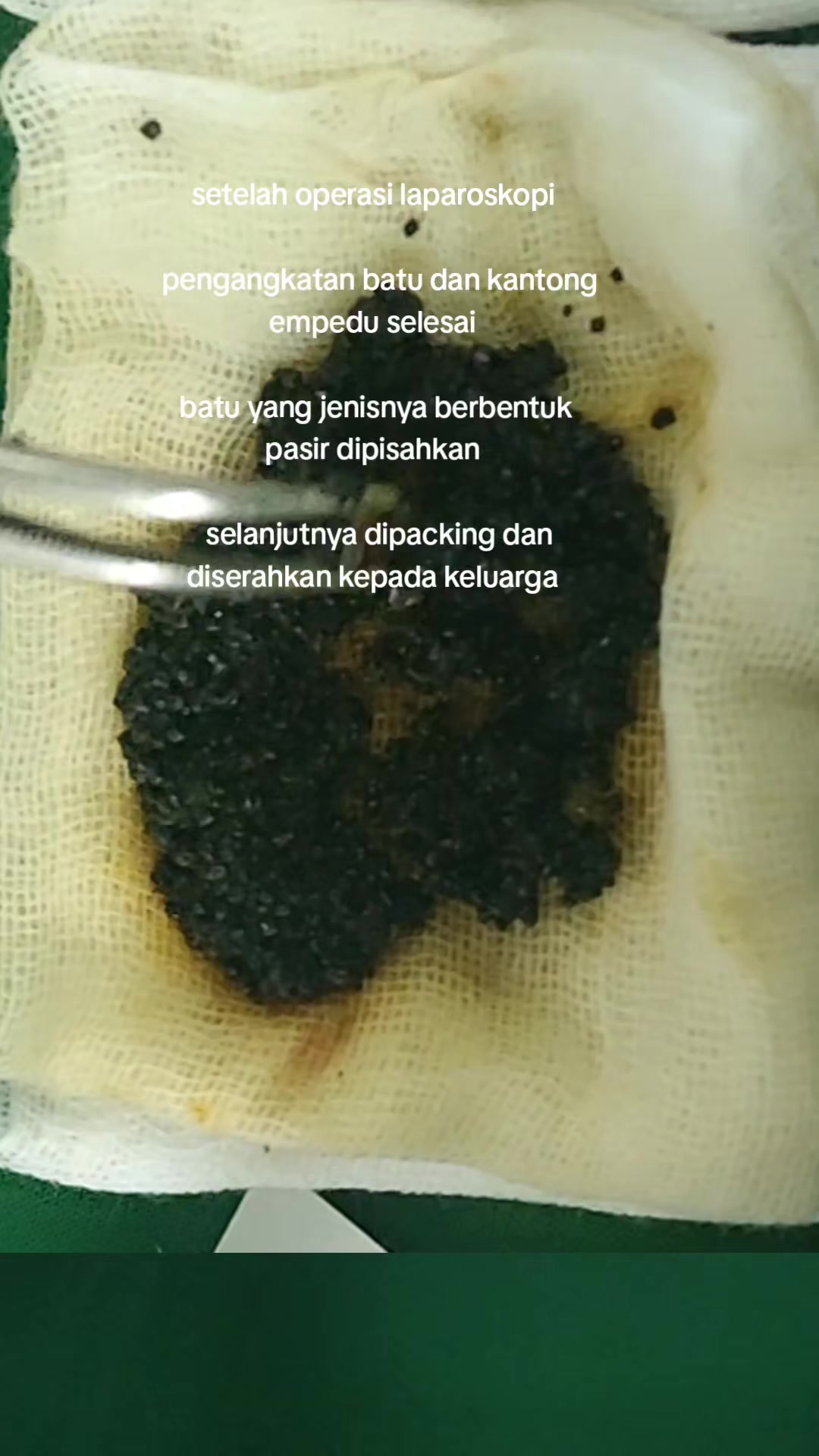 @KAMAR OPERASI