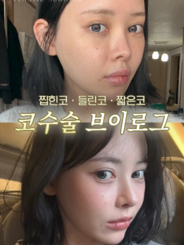 @리셋성형외과