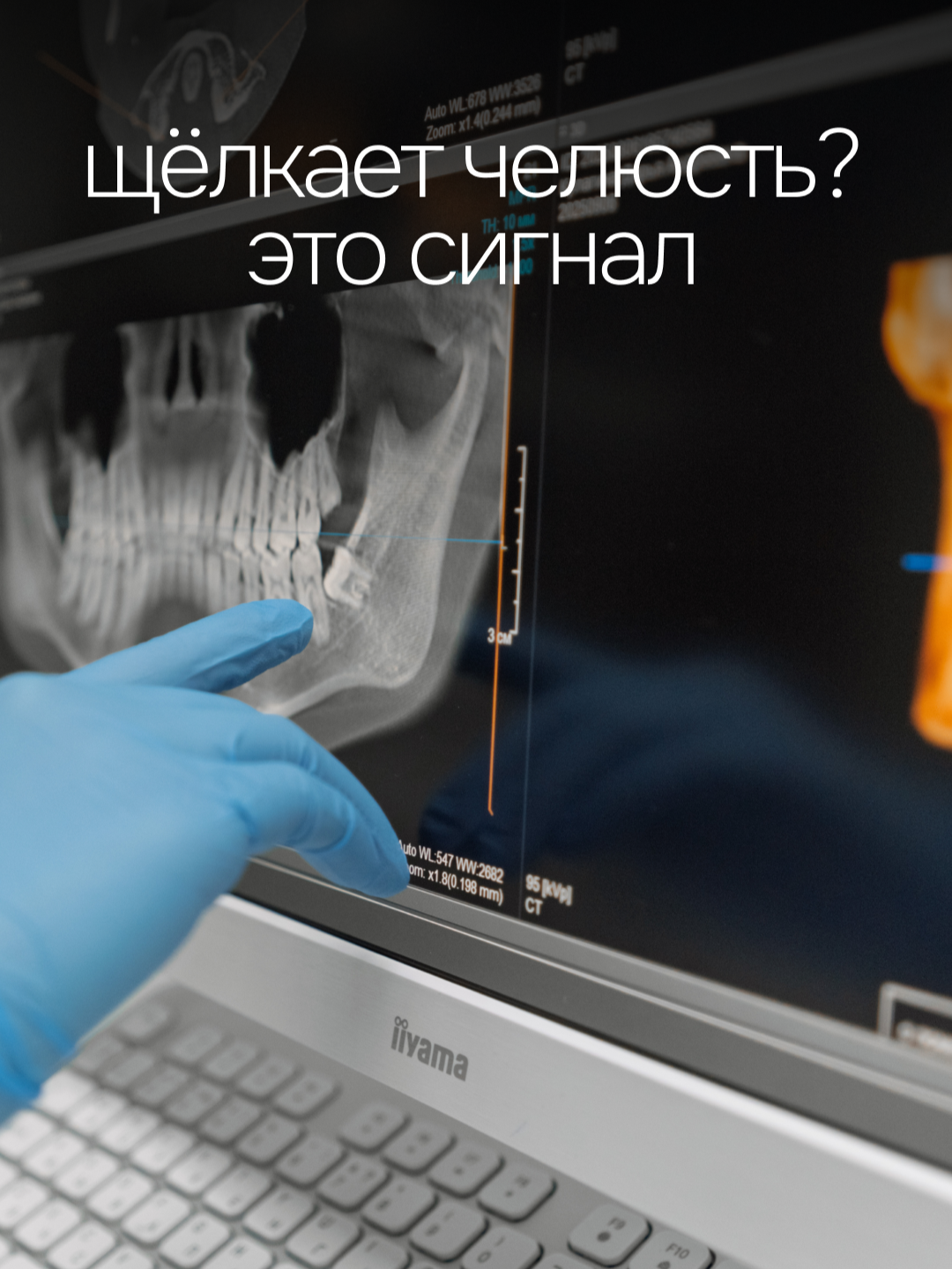 @Глеб Пекли