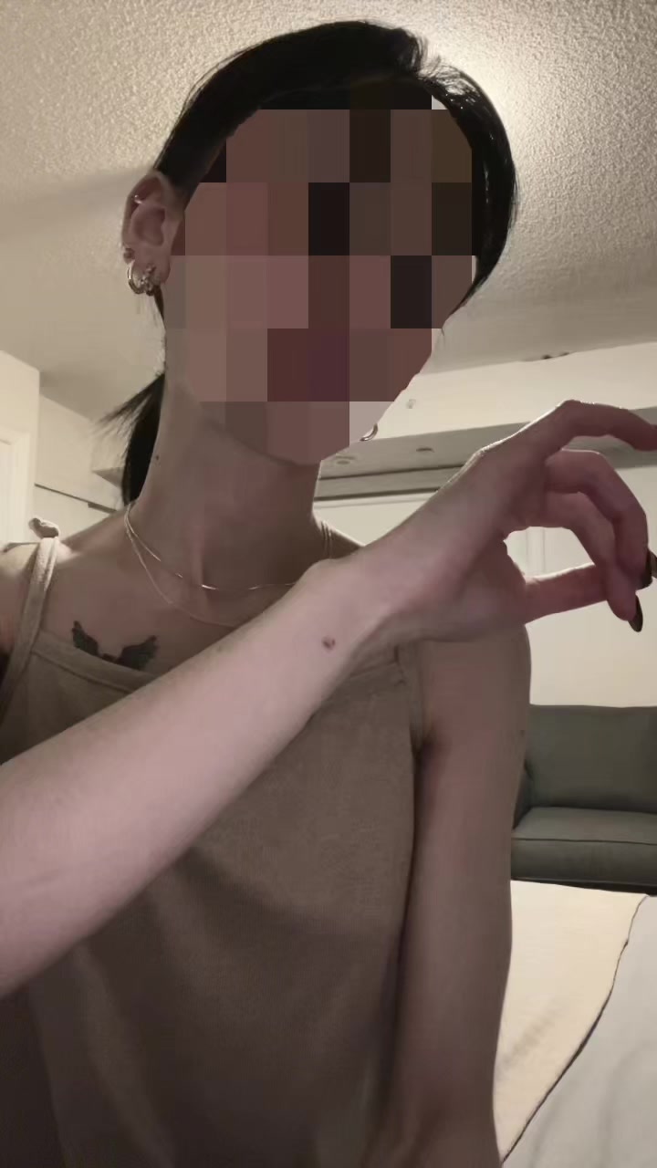 @skin_im_in00