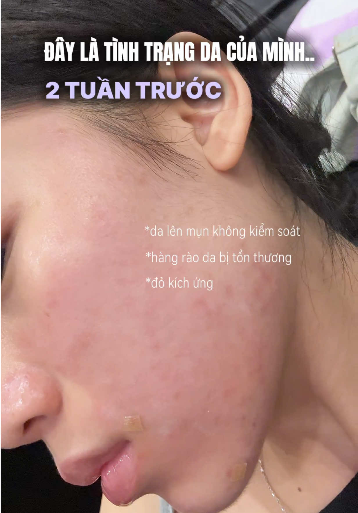 @chưa mối tình đầu