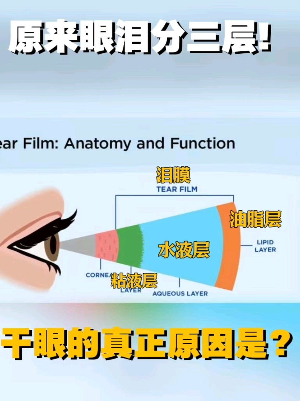 @🇺🇸西雅图/波特兰 King Lasik 近视老花手术
