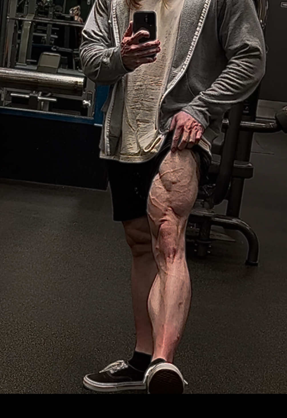 @LucasFit