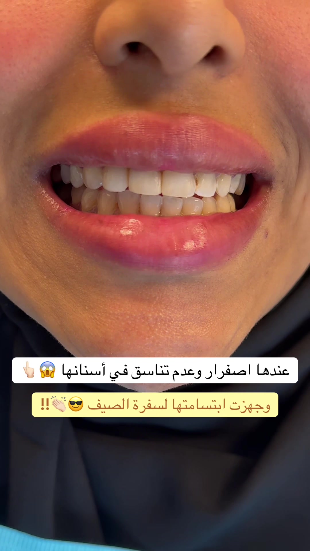 @Dr.lina_almasmoum