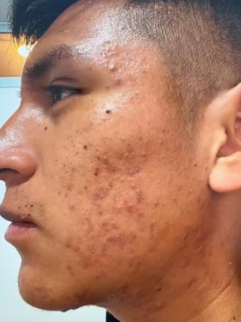 @RebellSpa