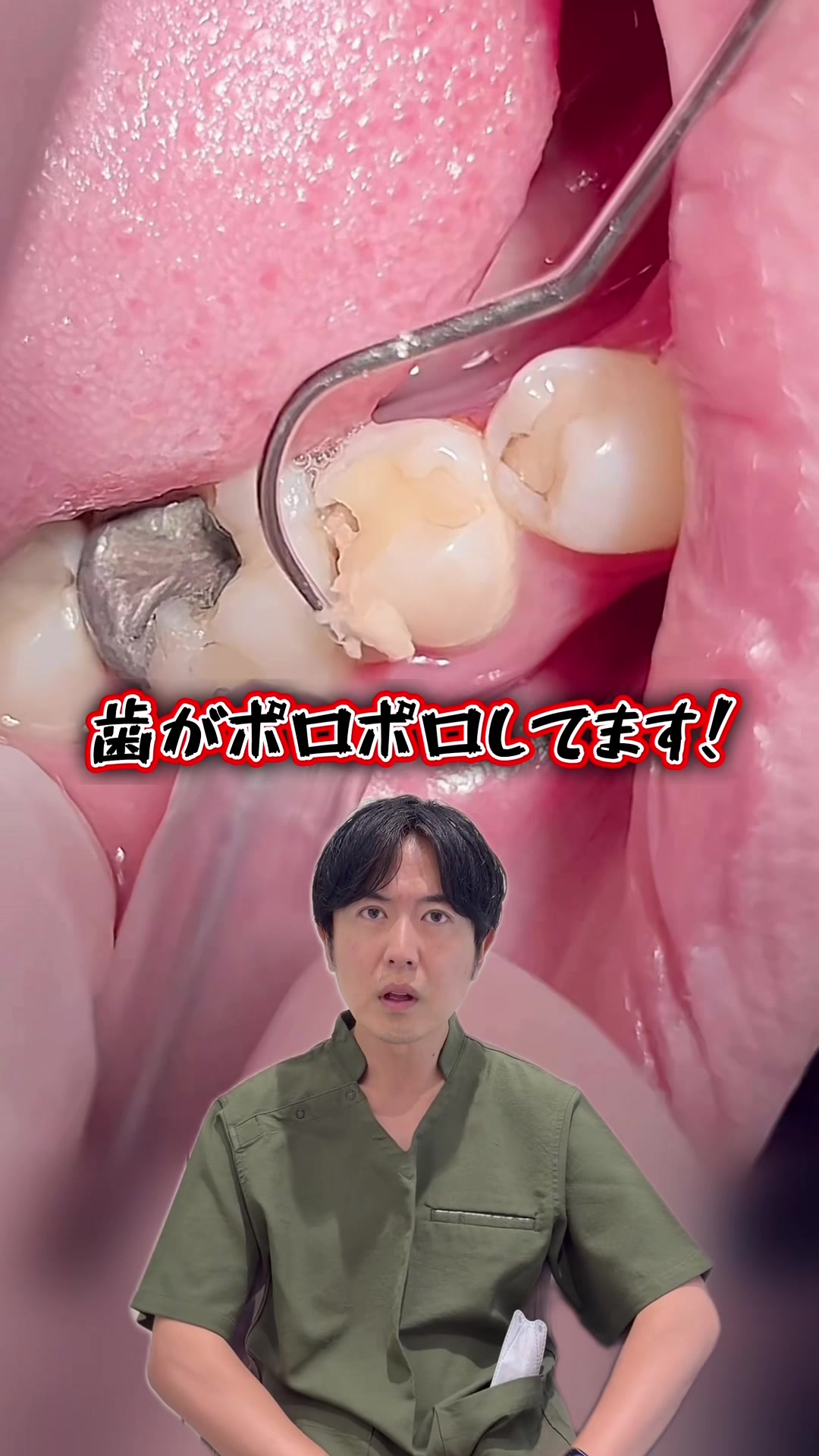 @Dr.山元(湘南歯科クリニック心斎橋院)