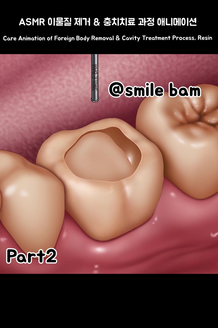 @Smile Bam