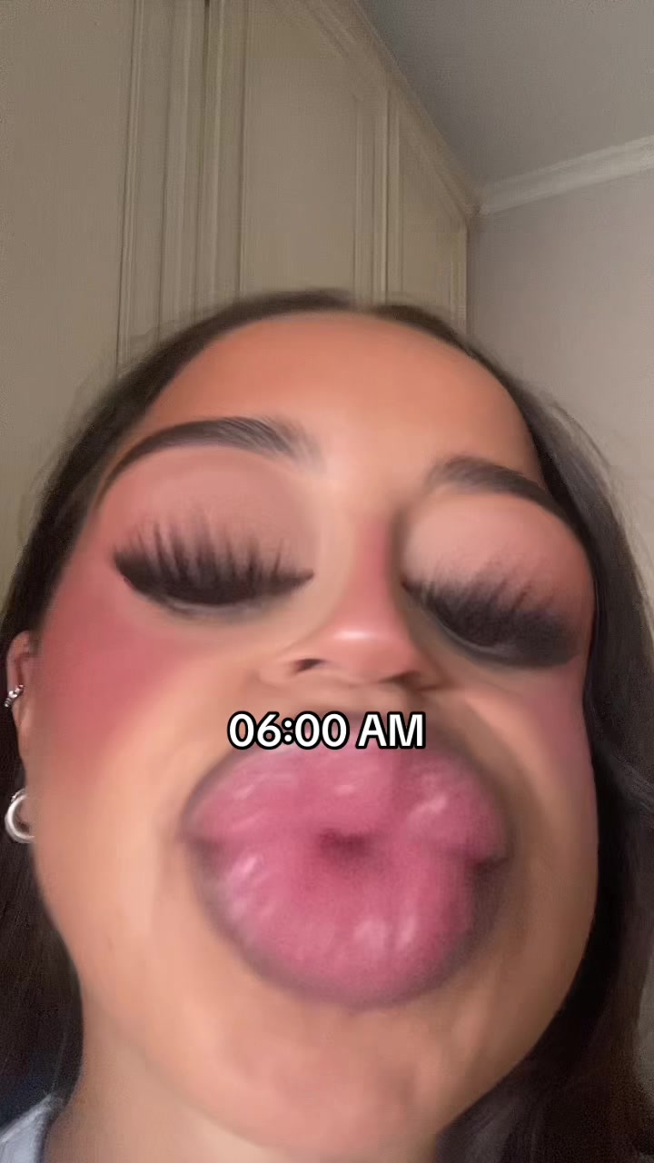 @Martina