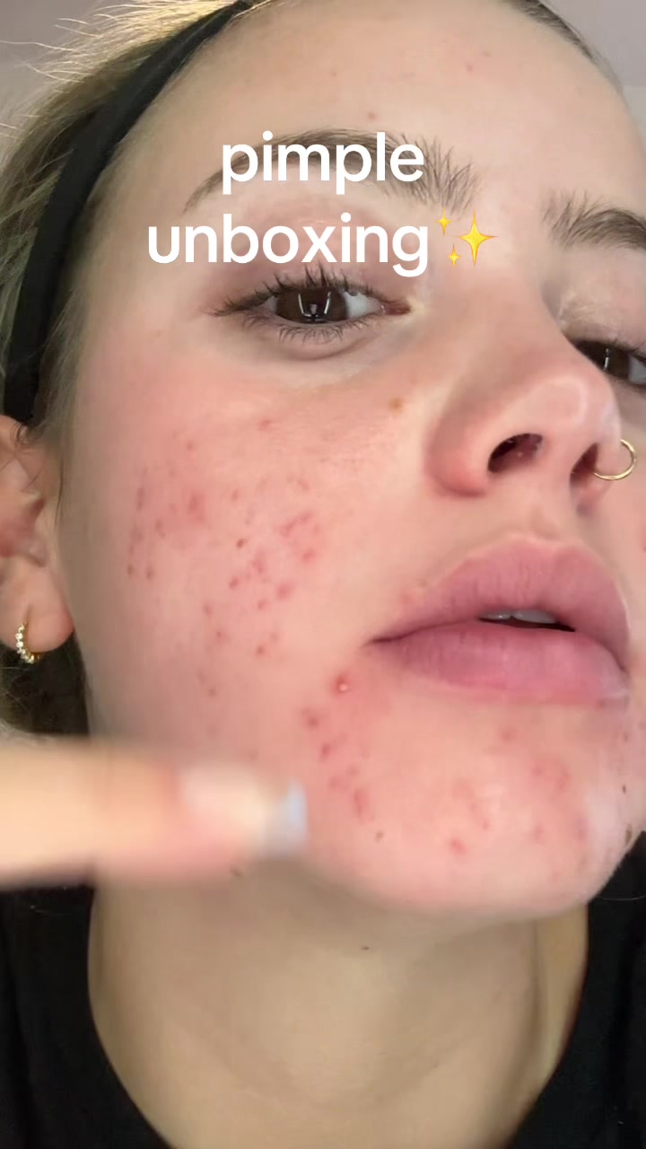 @cheeto🙈