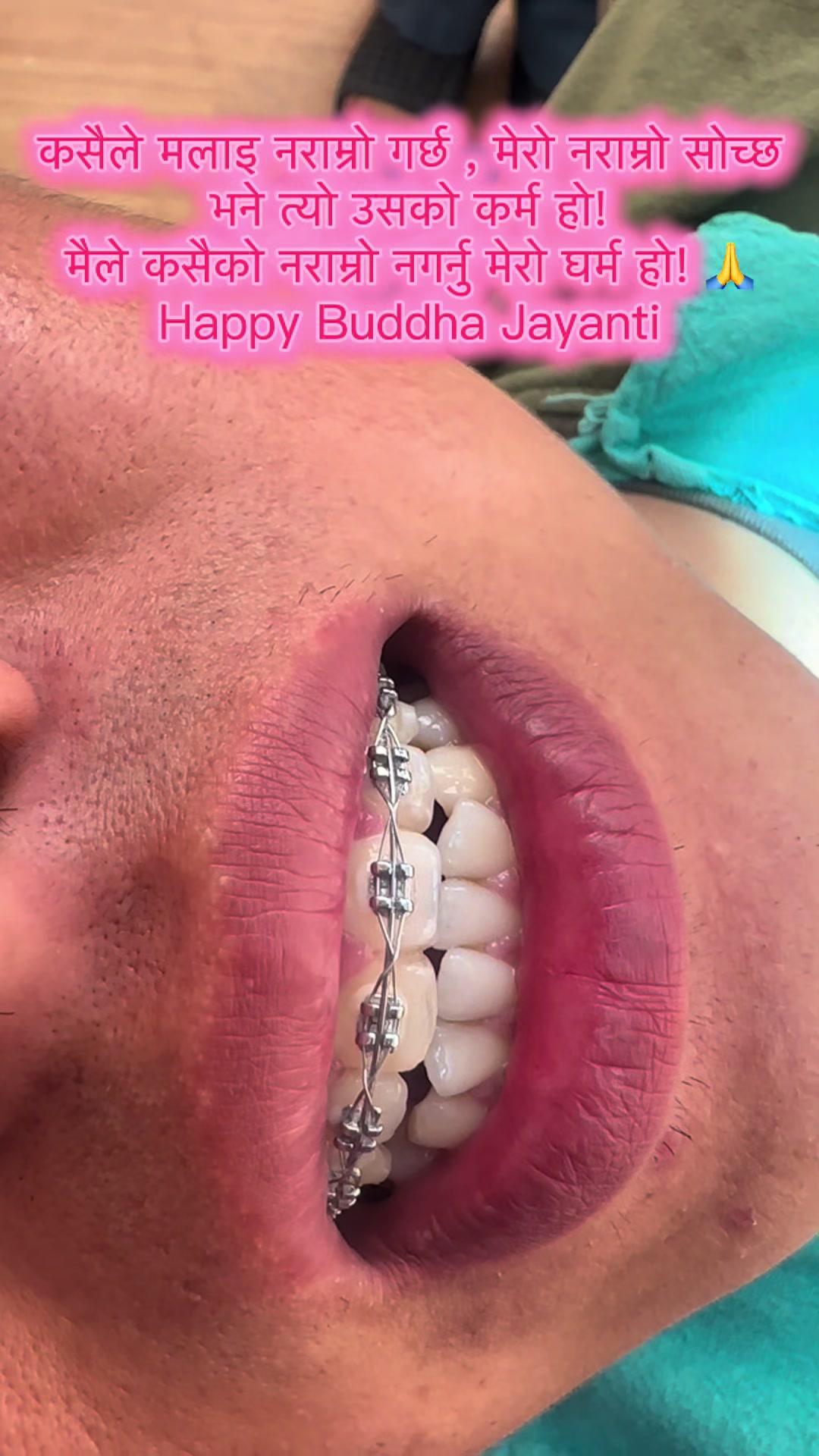 @vaidurya_dental_clinic
