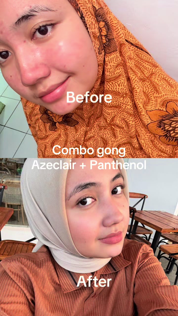 @Nanauyyyy