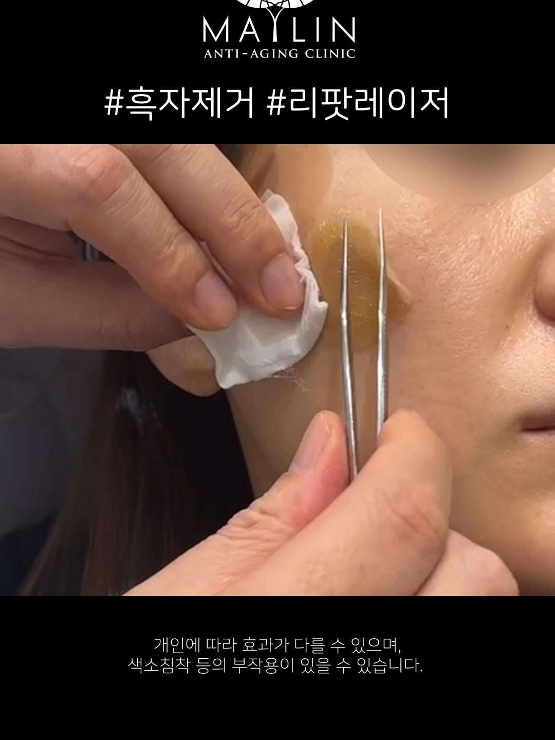 @메이린의원대구점