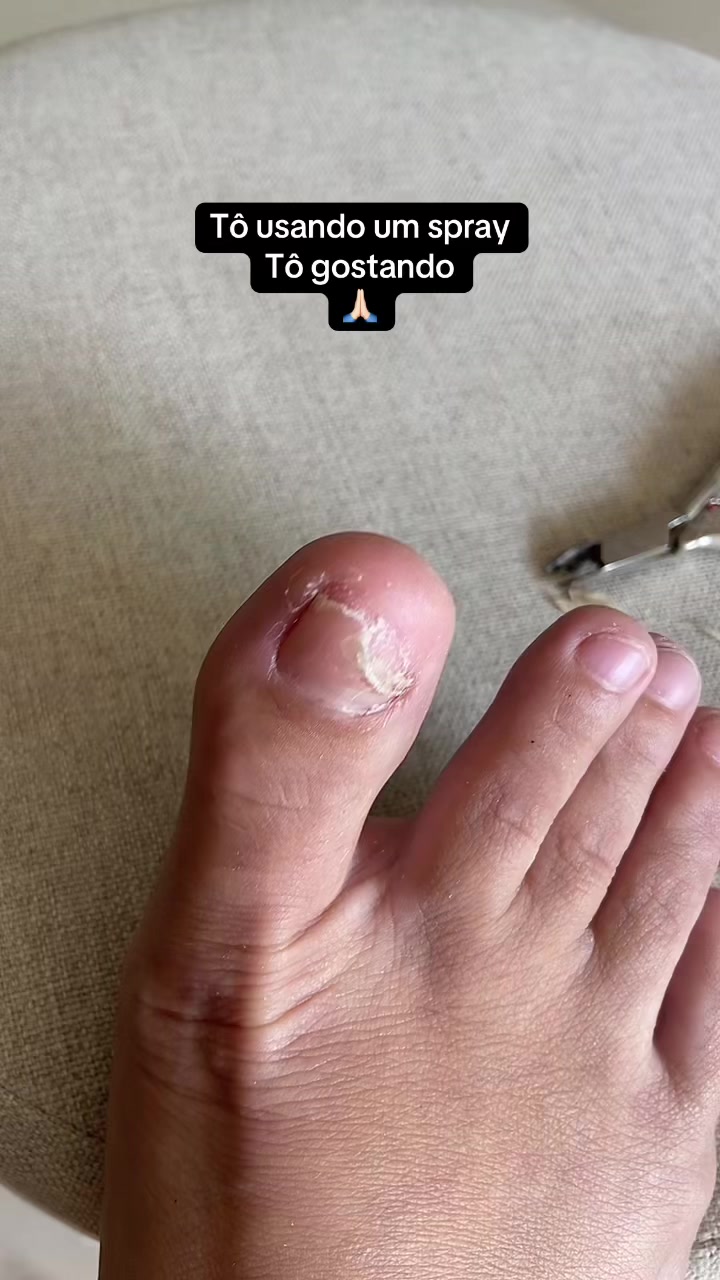 @Carolinaindica