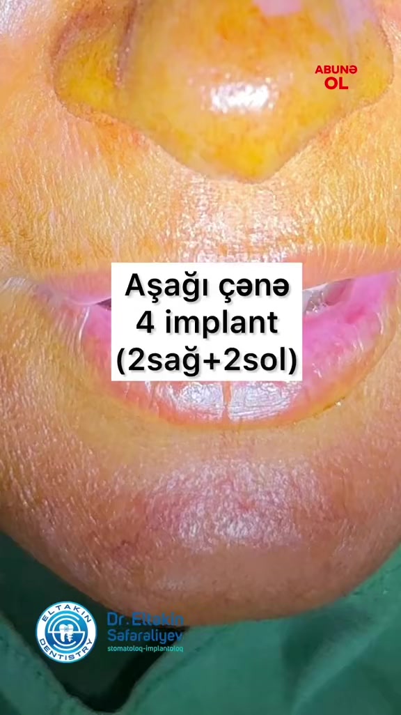 @eltakindentistry