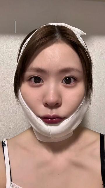 @金澤紀臣【小顔/若返り/脂肪吸引】