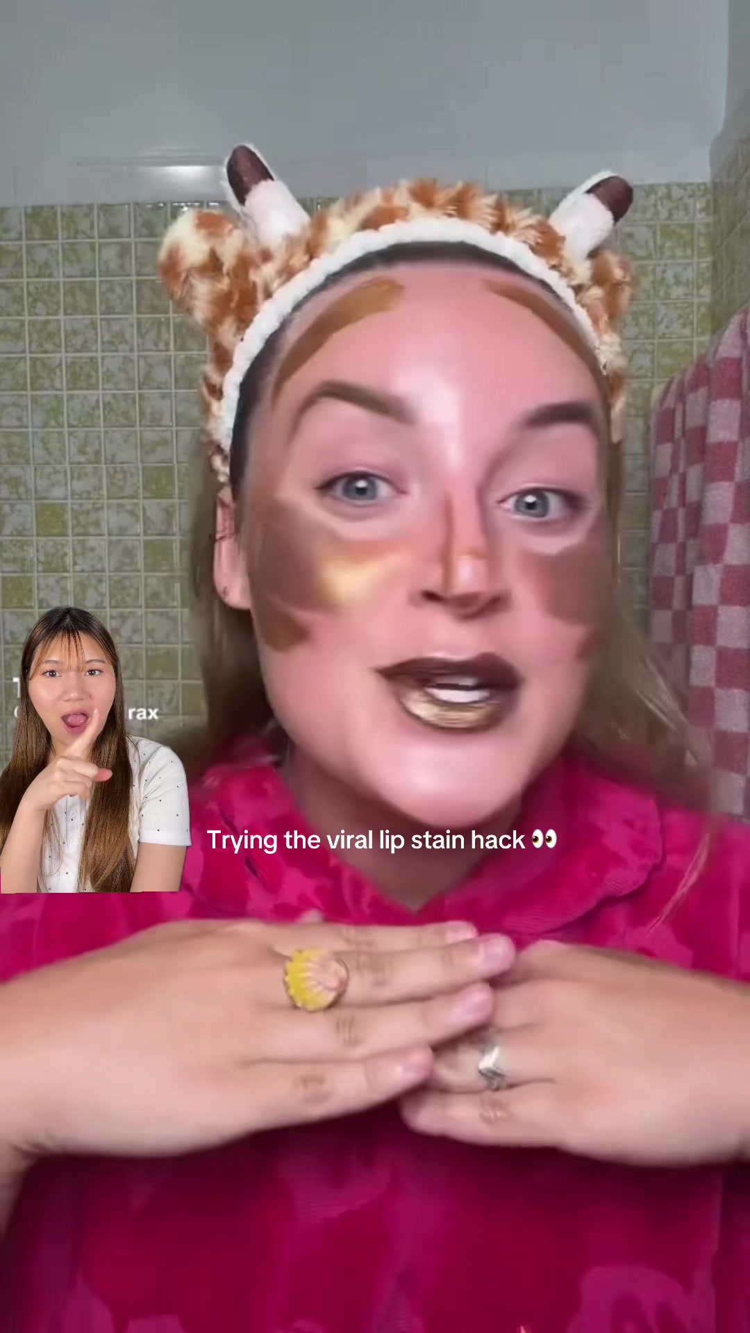 @Sonuka๐ขึดเป๐เผโ