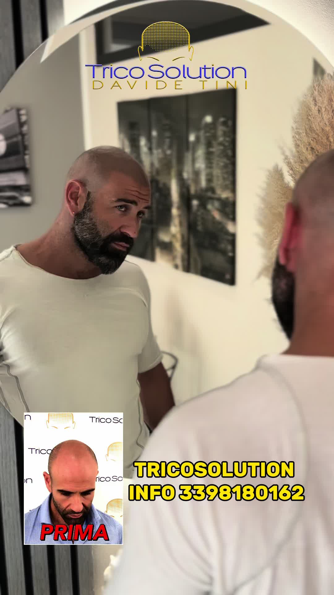 @TricoSolution di Davide Tini