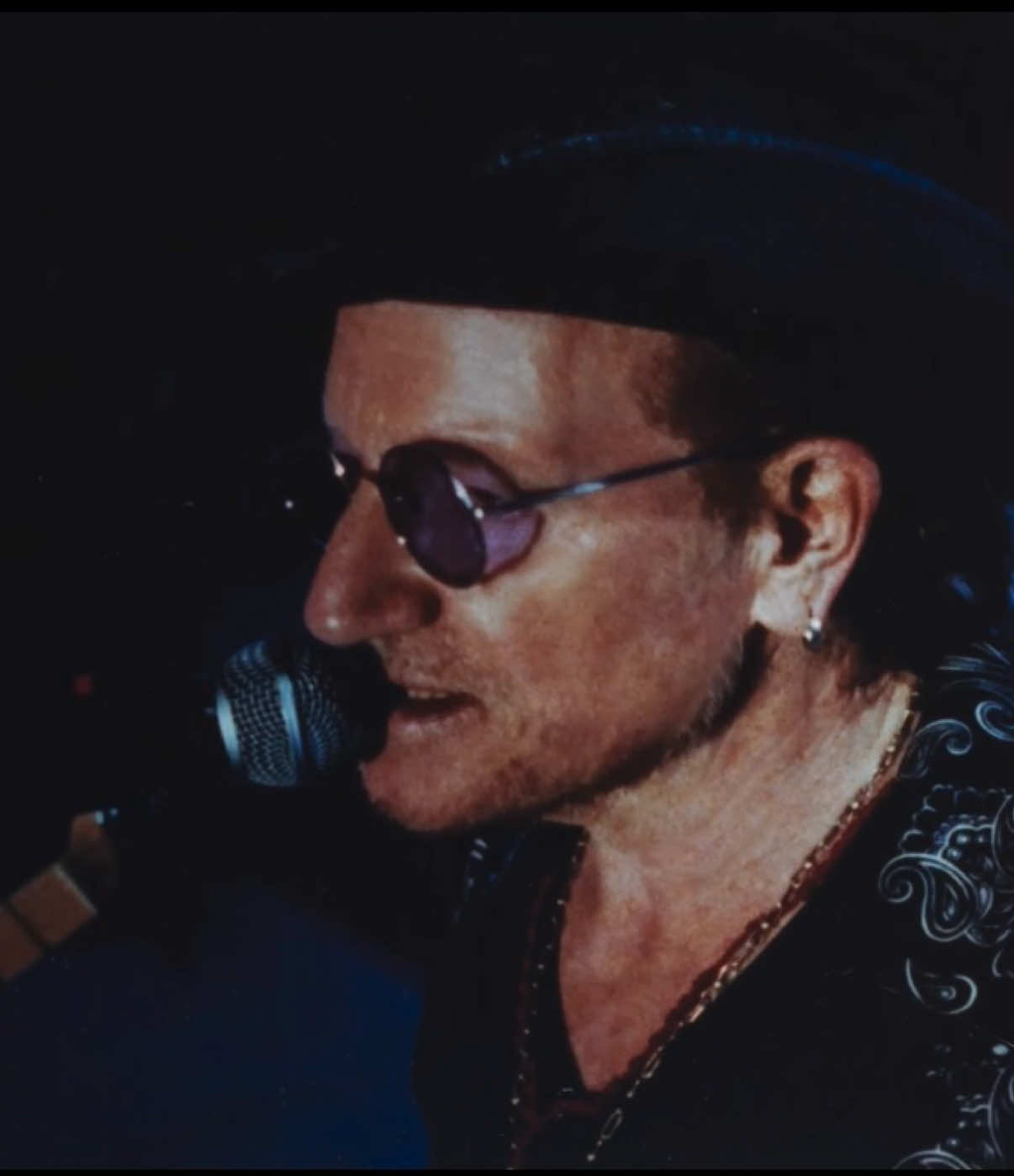 @U2