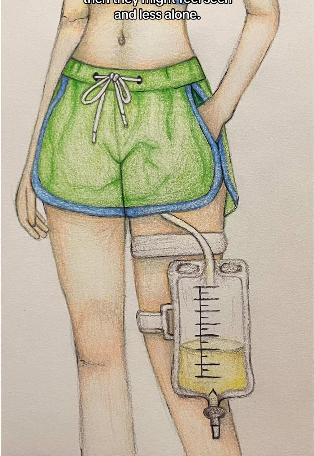 @Neveticsalot