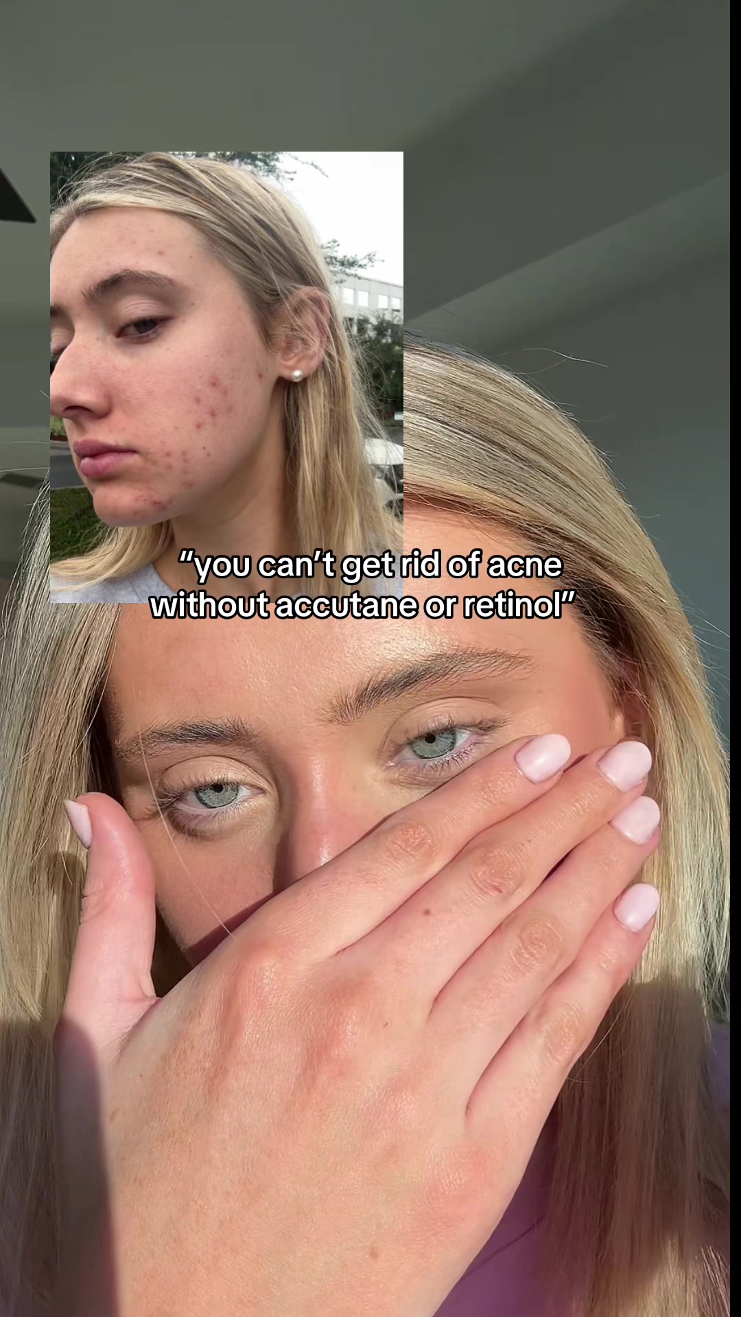 @laurennn
