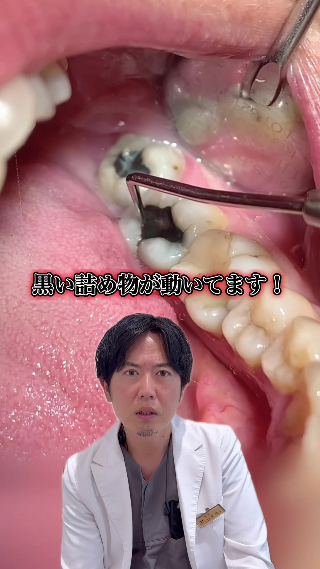 @Dr.山元(湘南歯科クリニック心斎橋院)