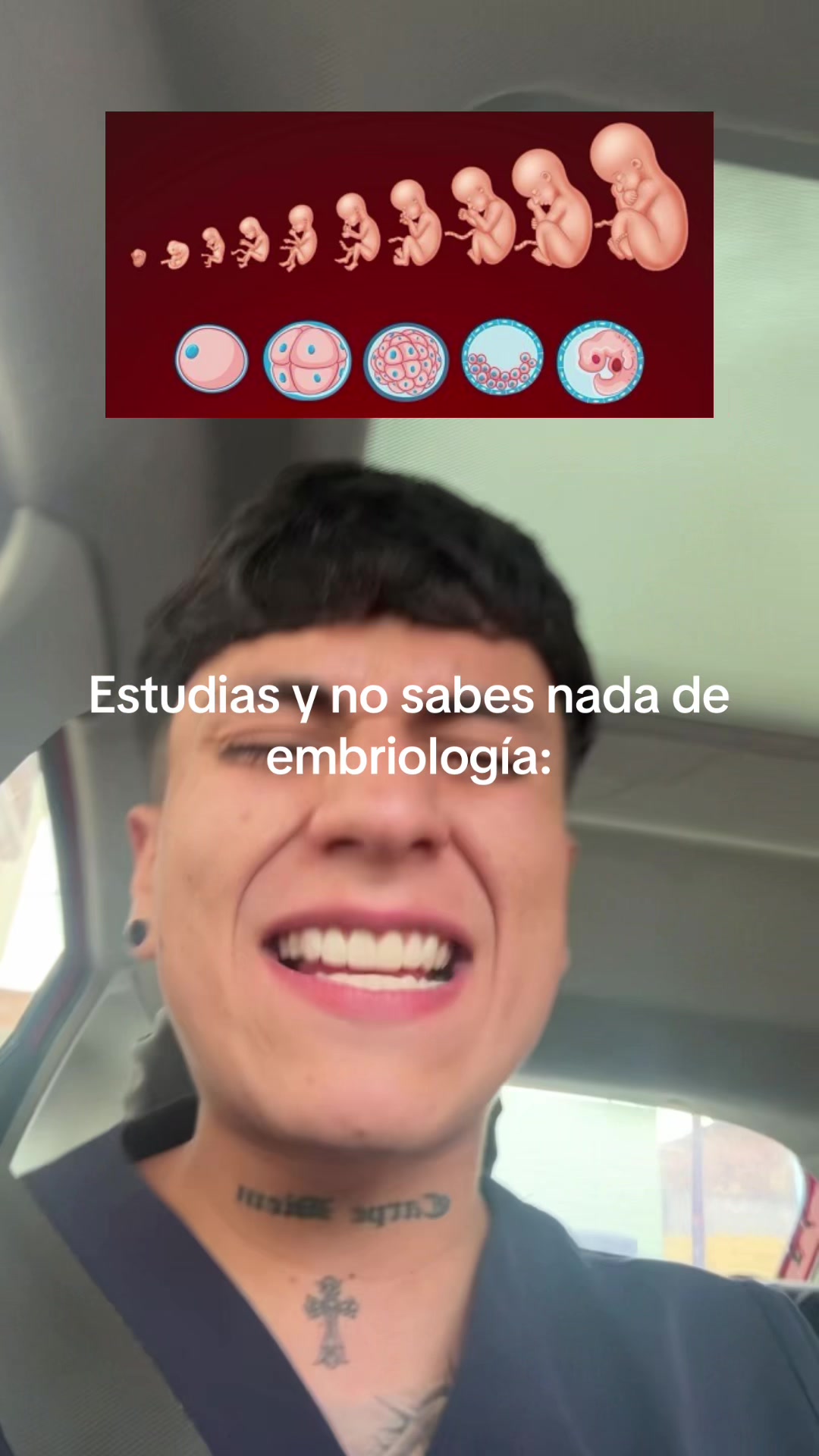 @ENDOBOY