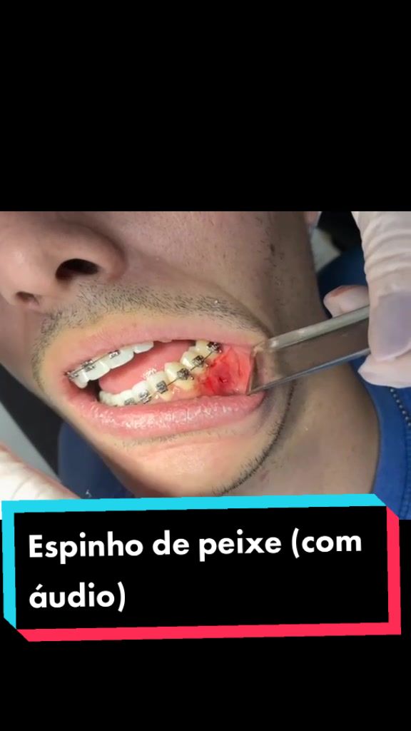 @Adriano Pacheco