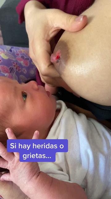 @Enfermera IBCLC