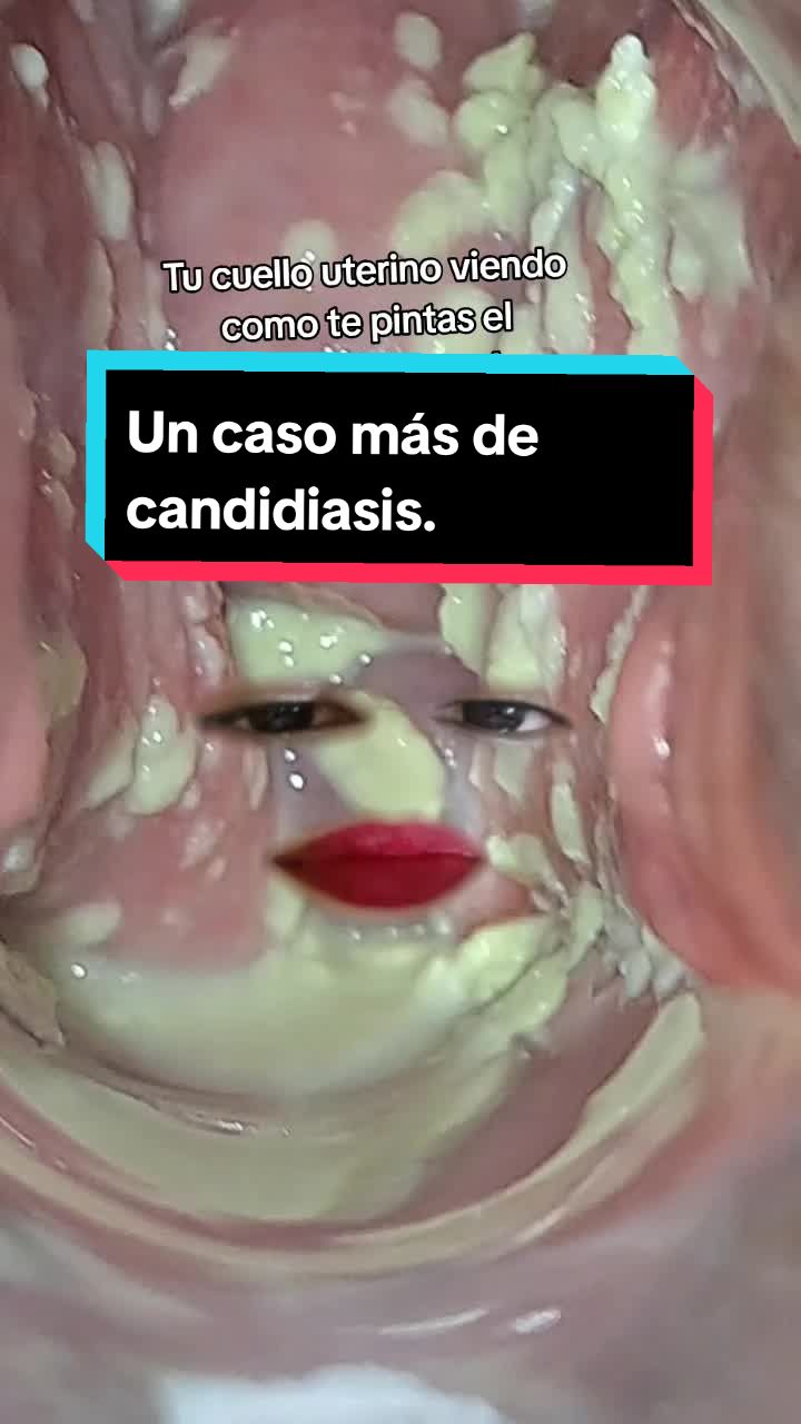 @OBST. KEYLA SALTOS