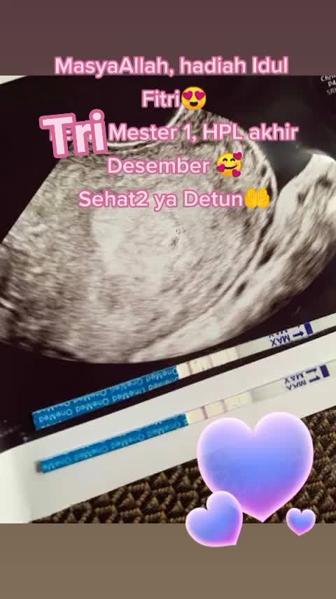 @Nurul_Amelia