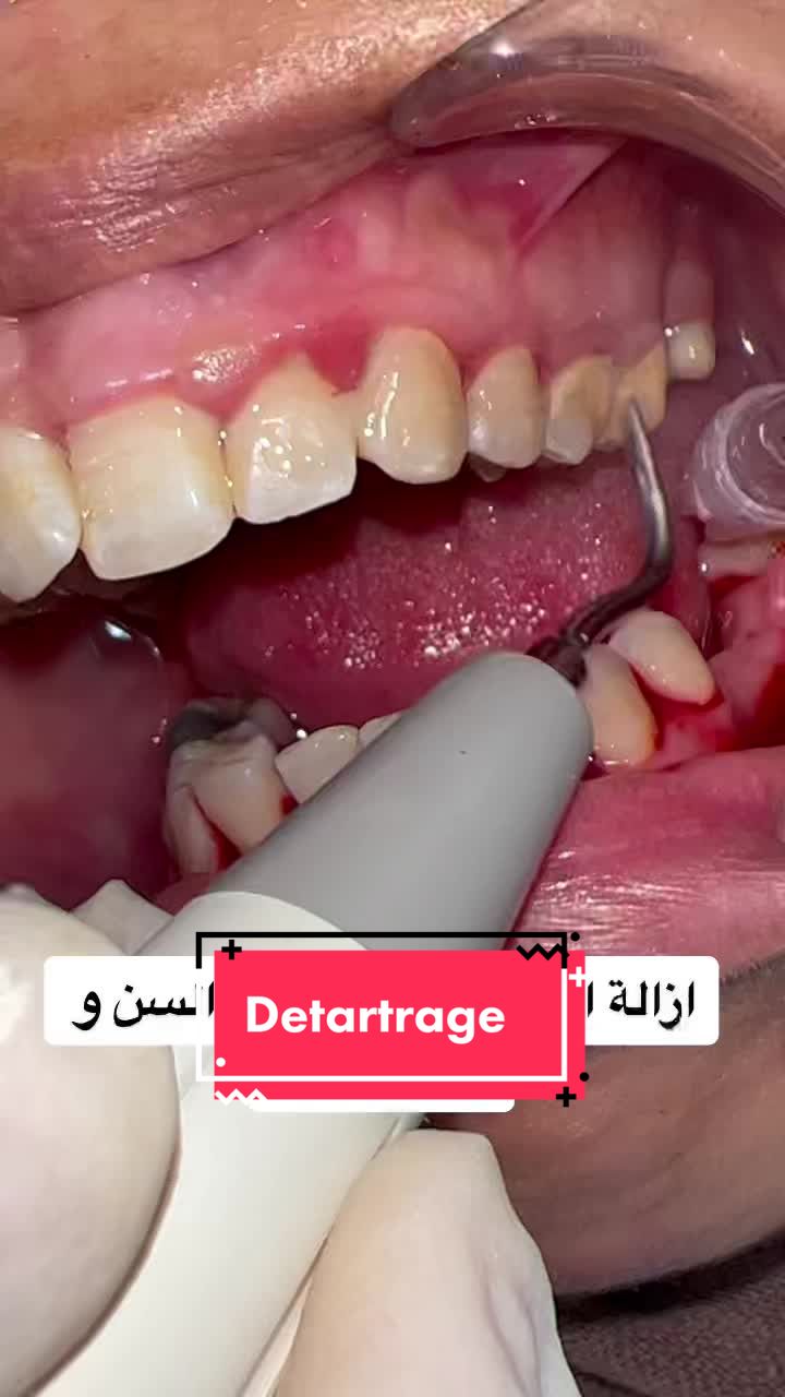@Sarra Ouertani