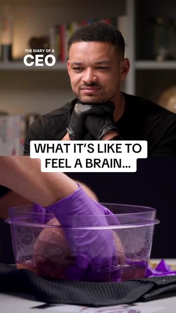 This is what a real human brain looks | The Diary Of A CEO (@steven)