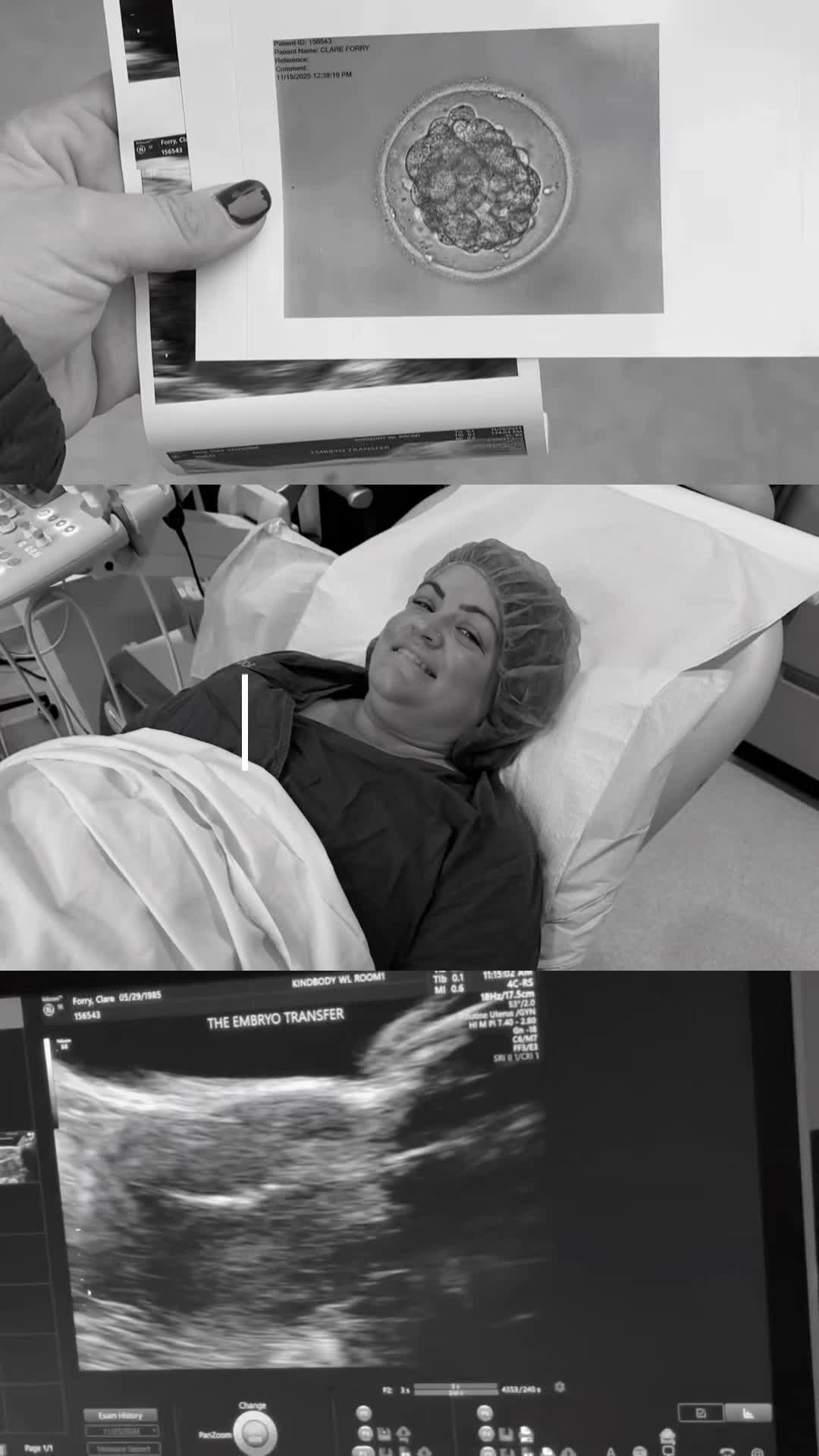 @Clare Elisabeth | IVF Journey