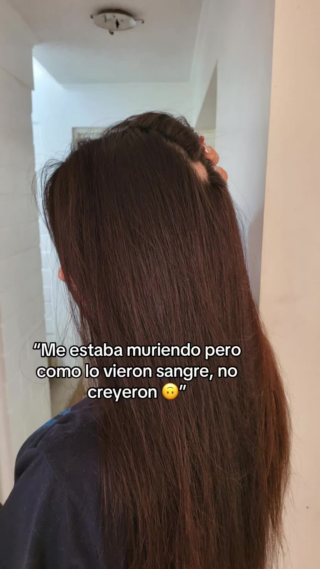 @Shampoodecebolla