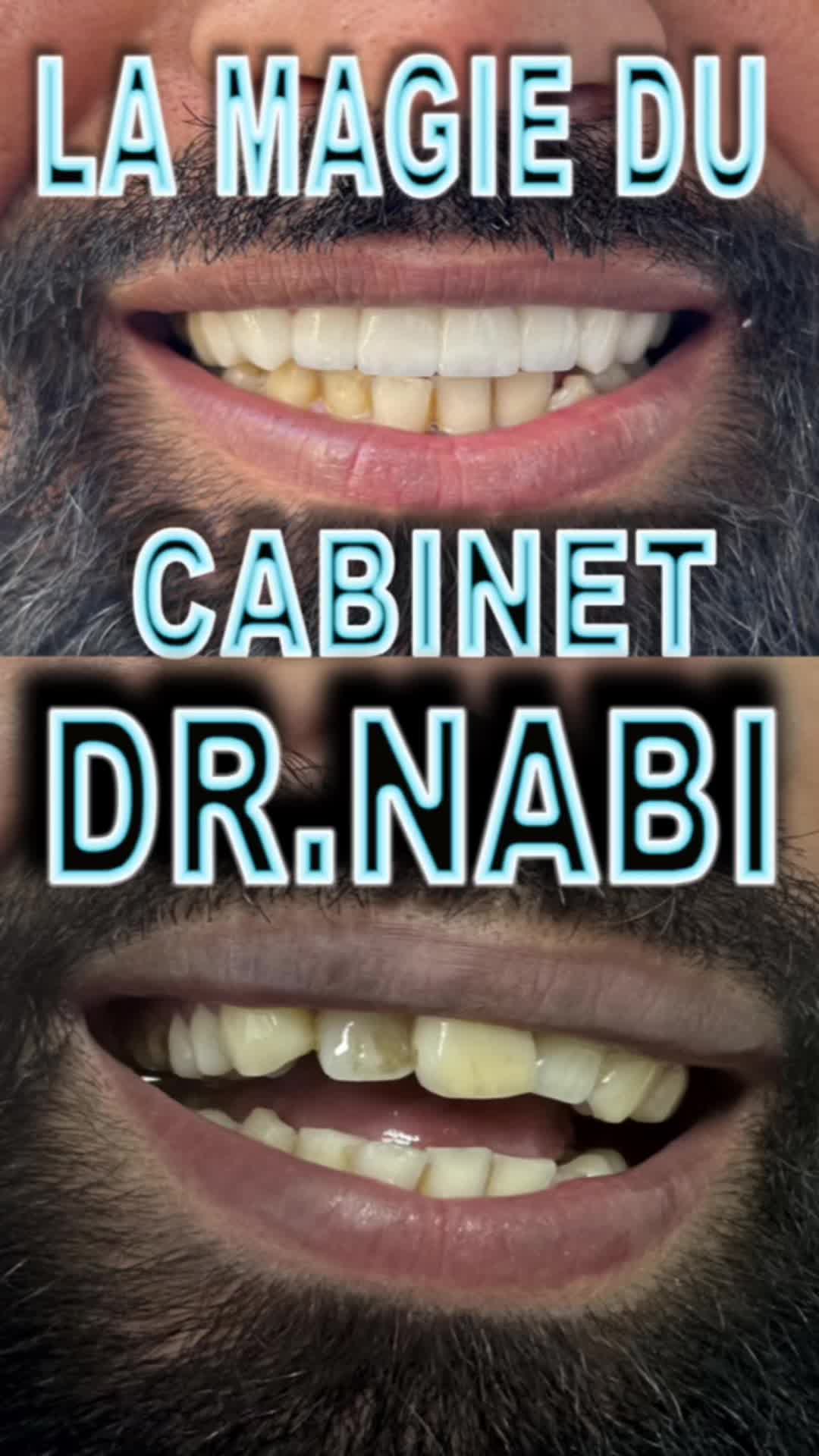 @Dr Nabi-Couture Smile