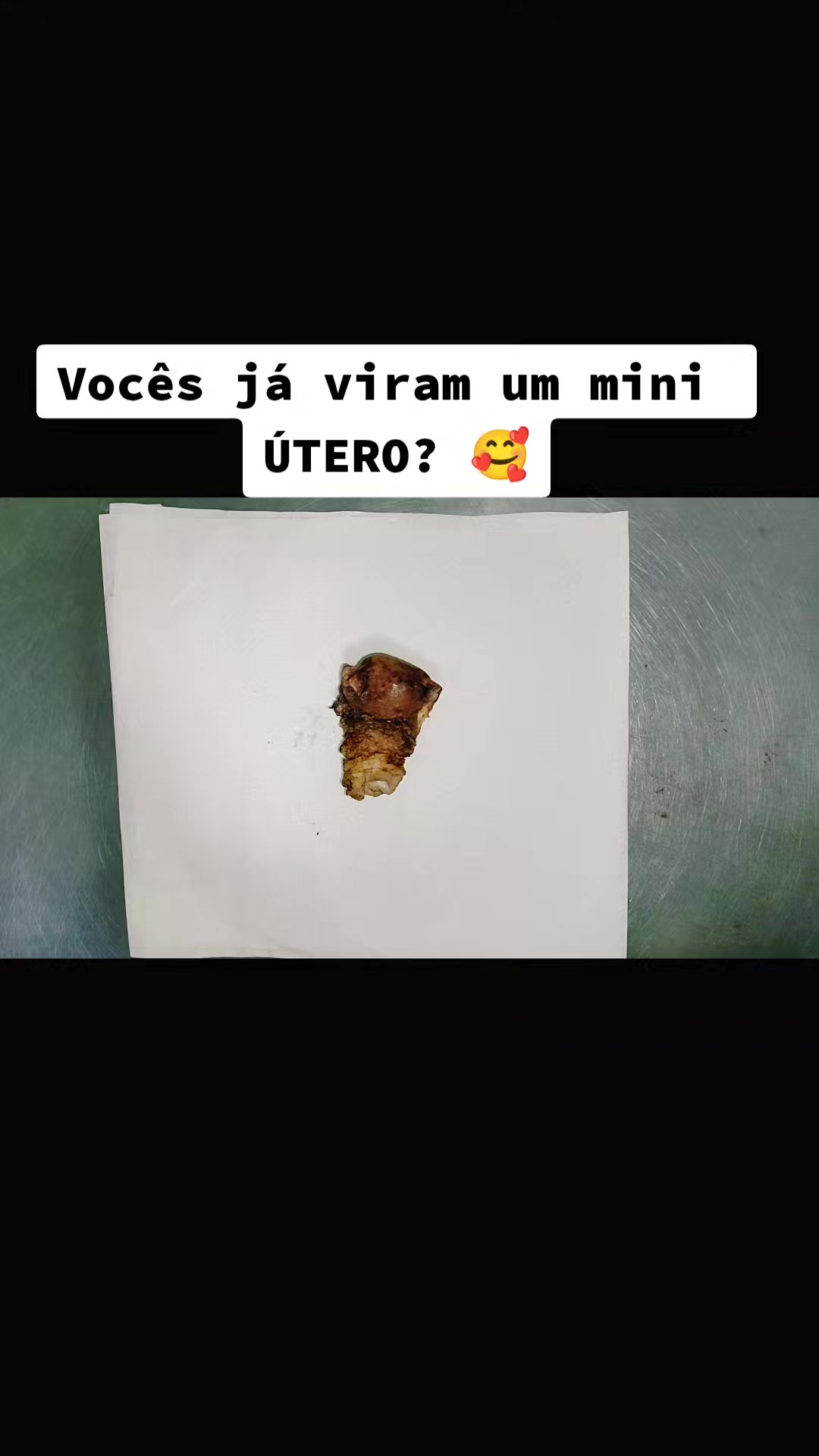 @Jeferson7199