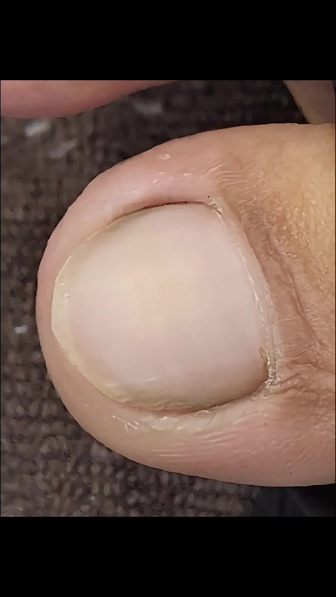 @Toenails.clips